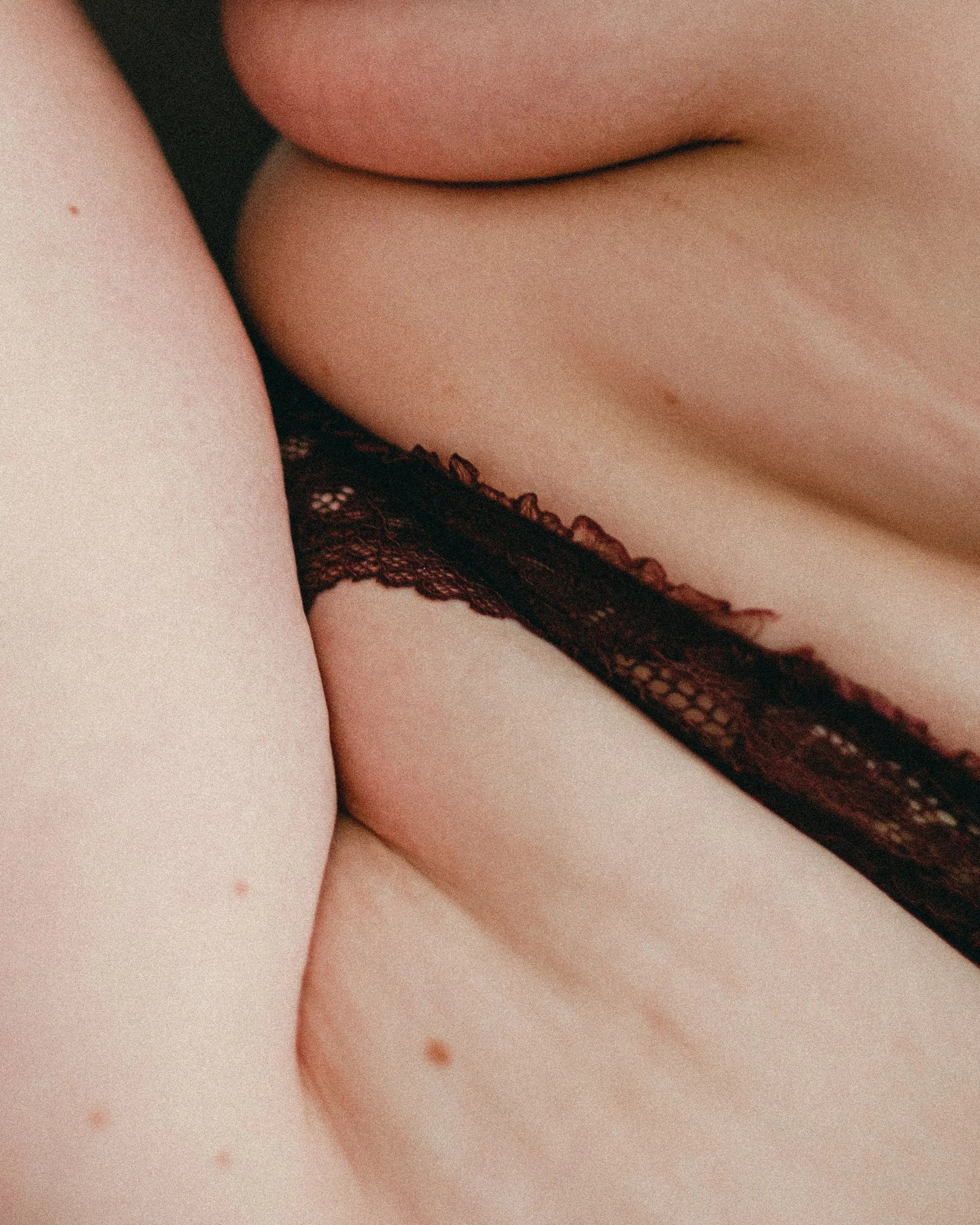 Dehnungsstreifen, Cellulite und Co. - Warum wir Körpermale respektieren und schätzen - ELIXR